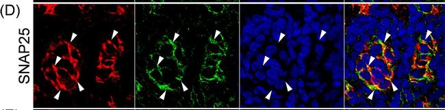 Mouse IgG (H+L) Cross-Adsorbed Secondary Antibody in Immunohistochemistry (IHC)