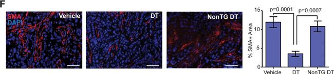 Mouse IgG (H+L) Highly Cross-Adsorbed Secondary Antibody in Immunohistochemistry (Paraffin) (IHC (P))