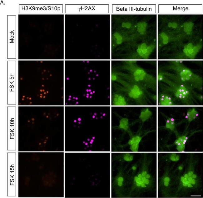 Mouse IgG (H+L) Cross-Adsorbed Secondary Antibody in Immunocytochemistry (ICC/IF)