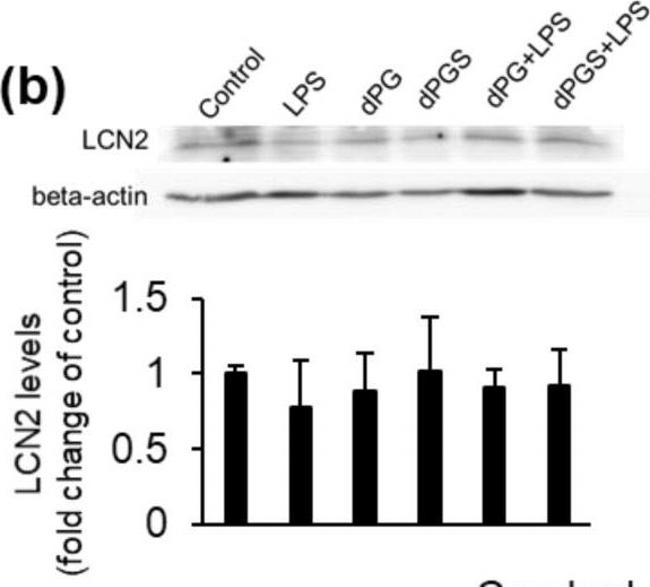 Rat IgG (H+L) Secondary Antibody in Western Blot (WB)