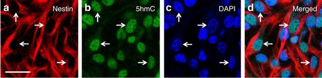 Mouse IgG (H+L) Cross-Adsorbed Secondary Antibody in Immunocytochemistry (ICC/IF)