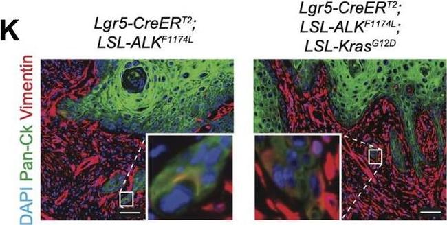 Rabbit IgG (H+L) Cross-Adsorbed Secondary Antibody in Immunohistochemistry (IHC)