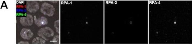 Rabbit IgG (H+L) Highly Cross-Adsorbed Secondary Antibody in Immunohistochemistry (IHC)