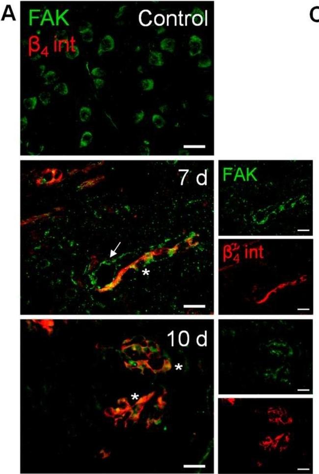 Rabbit IgG (H+L) Cross-Adsorbed Secondary Antibody in Immunocytochemistry (ICC/IF)