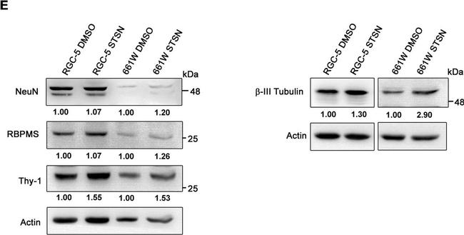 Rat IgG (H+L) Secondary Antibody in Western Blot (WB)