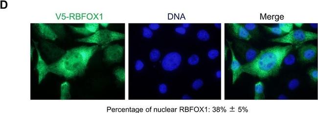 Rabbit IgG (H+L) Secondary Antibody in Immunohistochemistry (IHC)