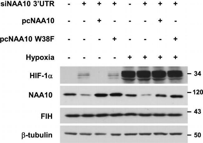 Rabbit IgG (H+L) Cross-Adsorbed Secondary Antibody in Western Blot (WB)