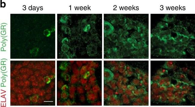 Rabbit IgG (H+L) Highly Cross-Adsorbed Secondary Antibody in Immunocytochemistry (ICC/IF)