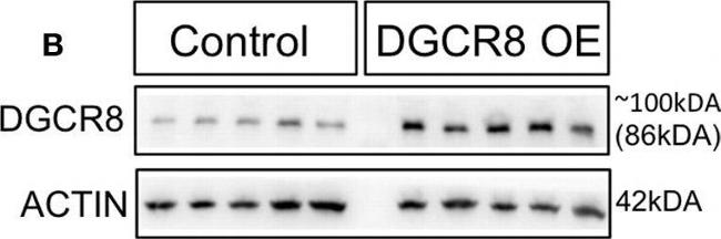 Rabbit IgG (H+L) Cross-Adsorbed Secondary Antibody in Western Blot (WB)