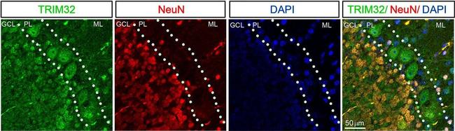 Mouse IgG (H+L) Highly Cross-Adsorbed Secondary Antibody in Immunohistochemistry (IHC)