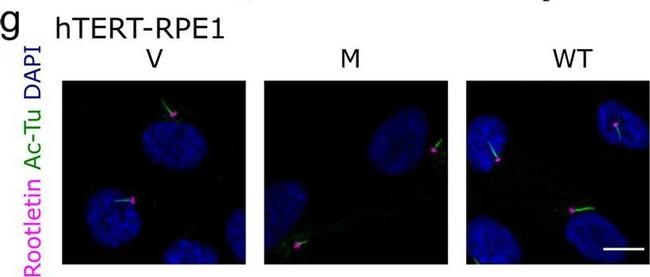 Mouse IgG (H+L) Cross-Adsorbed Secondary Antibody in Immunocytochemistry (ICC/IF)