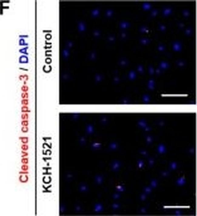 Rabbit IgG (H+L) Cross-Adsorbed Secondary Antibody in Immunocytochemistry (ICC/IF)