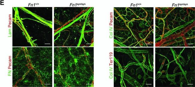 Rat IgG (H+L) Cross-Adsorbed Secondary Antibody in Immunohistochemistry (Paraffin) (IHC (P))