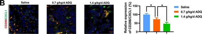 Mouse IgG (H+L) Cross-Adsorbed Secondary Antibody in Immunohistochemistry (IHC)