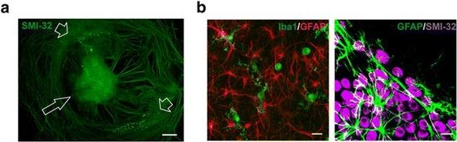 Mouse IgG (H+L) Cross-Adsorbed Secondary Antibody in Immunohistochemistry (IHC)