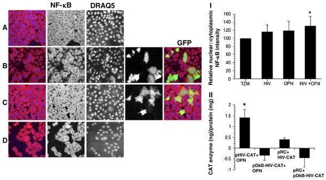 NFkB p65 Antibody in Immunohistochemistry (IHC)