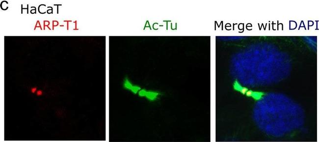 Mouse IgG (H+L) Cross-Adsorbed Secondary Antibody in Immunocytochemistry (ICC/IF)