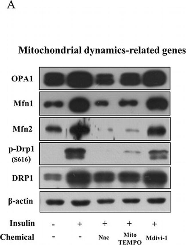 Rabbit IgG (H+L) Secondary Antibody in Western Blot (WB)