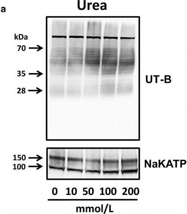 Mouse IgG (H+L) Secondary Antibody in Western Blot (WB)