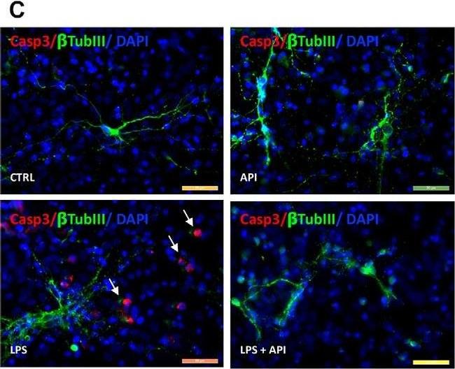 Rabbit IgG (H+L) Cross-Adsorbed Secondary Antibody in Immunocytochemistry (ICC/IF)