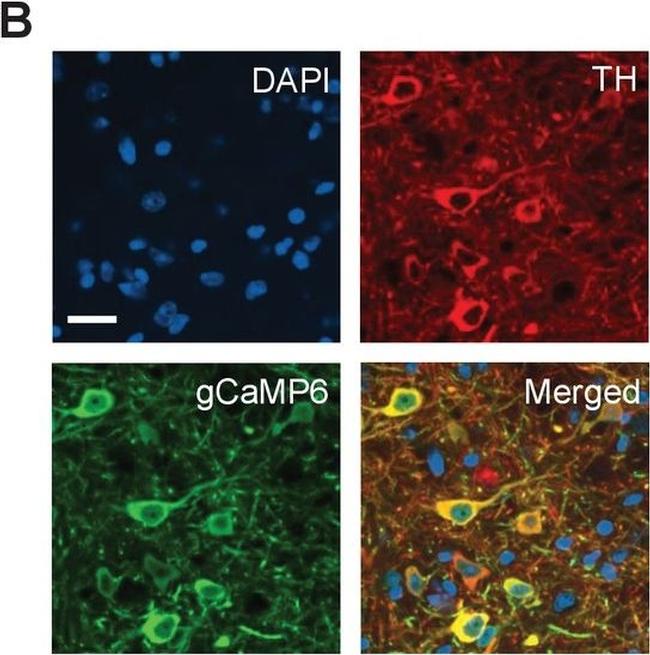 Mouse IgG (H+L) Cross-Adsorbed Secondary Antibody in Immunohistochemistry (IHC)