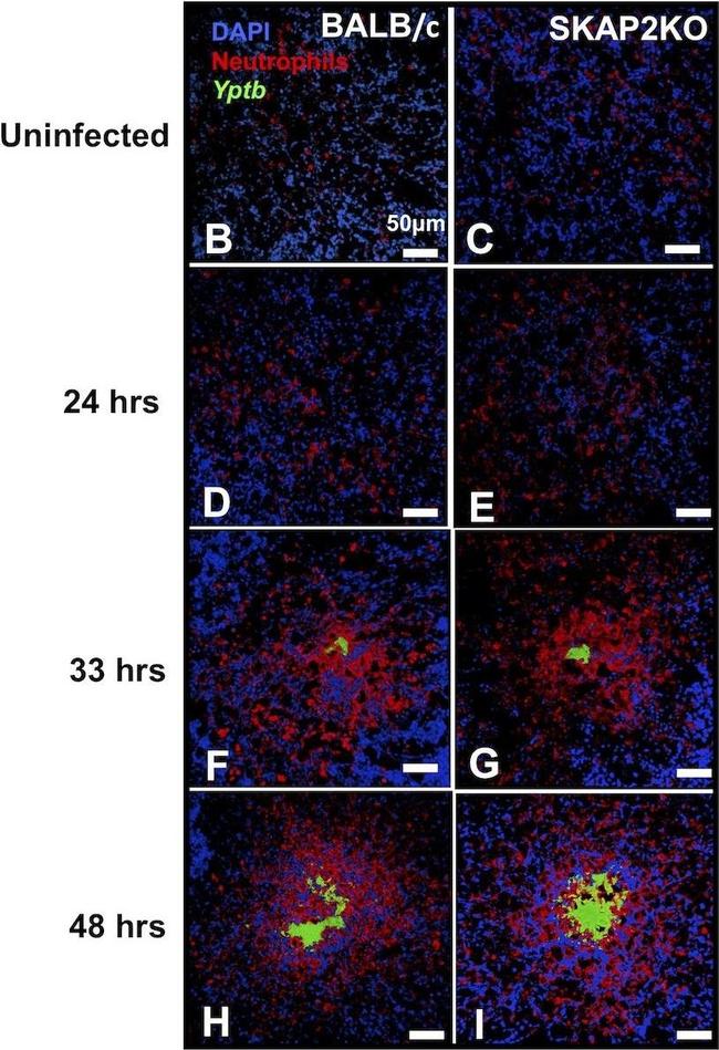 Rat IgG (H+L) Cross-Adsorbed Secondary Antibody in Immunohistochemistry (IHC)