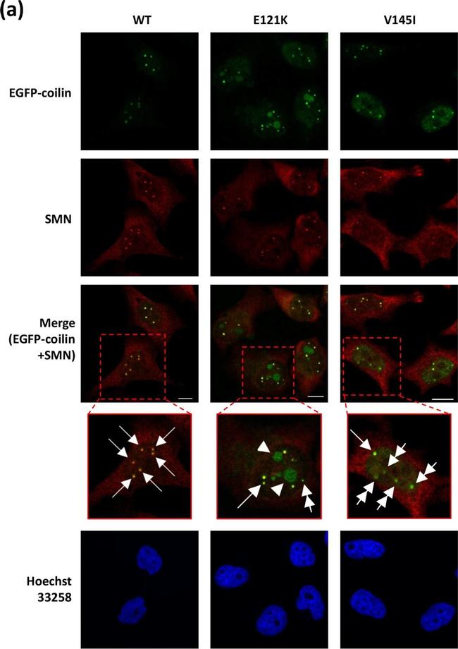 Mouse IgG (H+L) Secondary Antibody in Immunocytochemistry (ICC/IF)