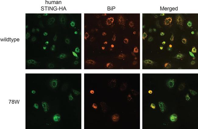 Mouse IgG (H+L) Highly Cross-Adsorbed Secondary Antibody in Immunocytochemistry (ICC/IF)