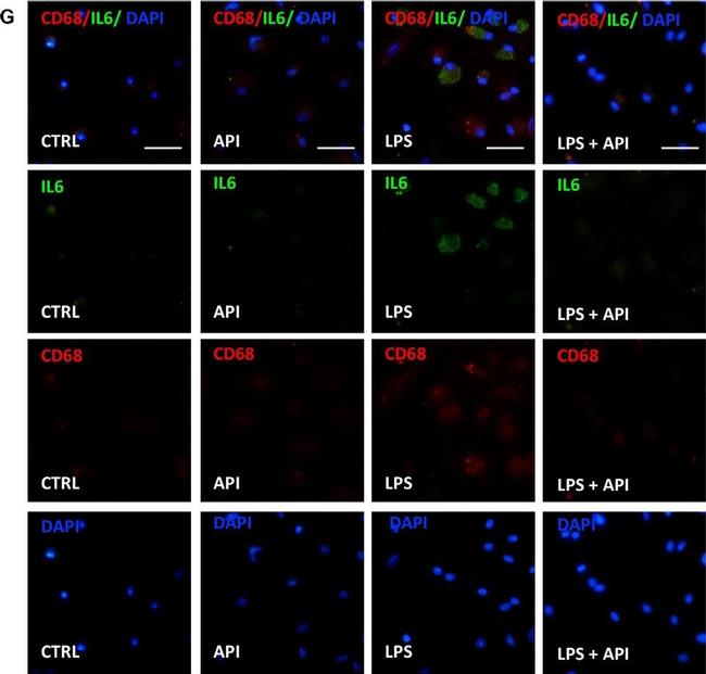 Rat IgG (H+L) Cross-Adsorbed Secondary Antibody in Immunocytochemistry (ICC/IF)