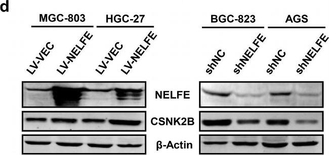 Rabbit IgG (H+L) Secondary Antibody in Western Blot (WB)