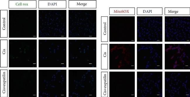 Rabbit IgG (H+L) Highly Cross-Adsorbed Secondary Antibody in Immunocytochemistry (ICC/IF)