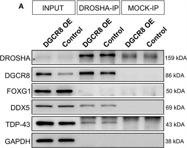 Rabbit IgG (H+L) Cross-Adsorbed Secondary Antibody in Western Blot (WB)