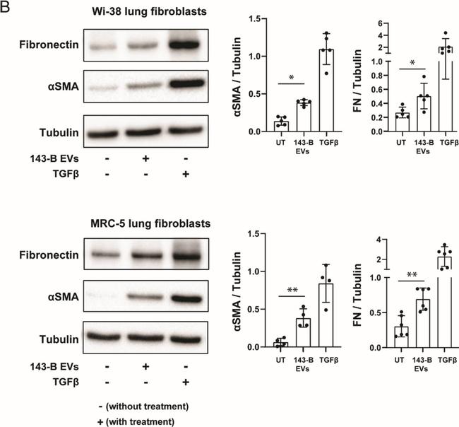 Mouse IgG, IgM, IgA (H+L) Secondary Antibody in Western Blot (WB)