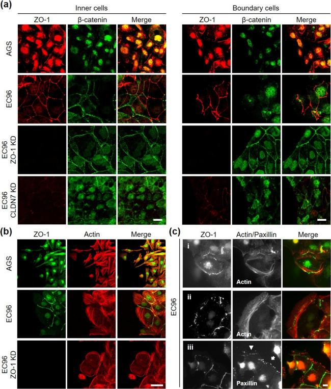 Mouse IgG (H+L) Cross-Adsorbed Secondary Antibody in Immunocytochemistry (ICC/IF)