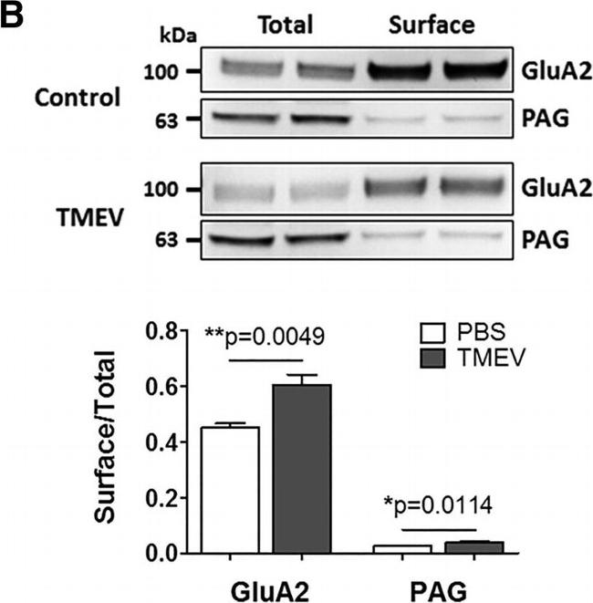 Rabbit IgG (H+L) Secondary Antibody in Western Blot (WB)