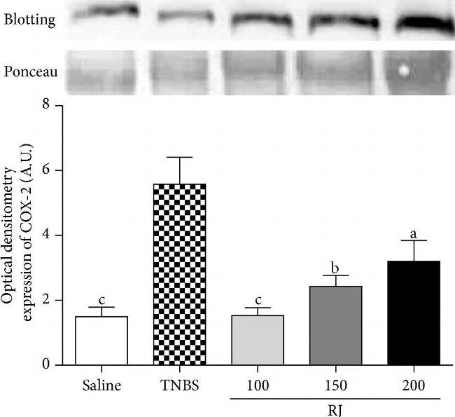 Rabbit IgG (H+L) Secondary Antibody in Western Blot (WB)