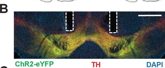 Mouse IgG (H+L) Cross-Adsorbed Secondary Antibody in Immunohistochemistry (IHC)