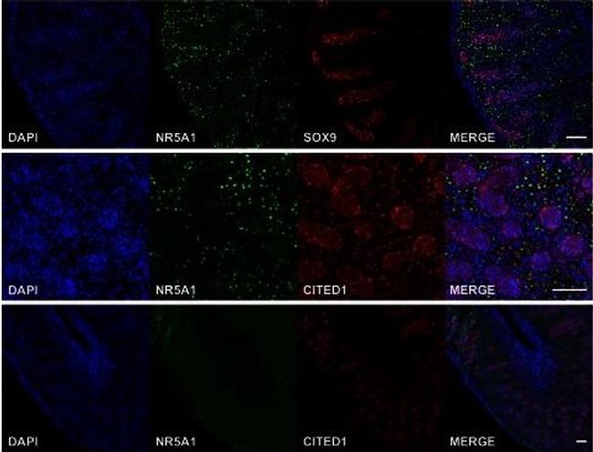 Rabbit IgG (H+L) Highly Cross-Adsorbed Secondary Antibody in Immunohistochemistry (IHC)