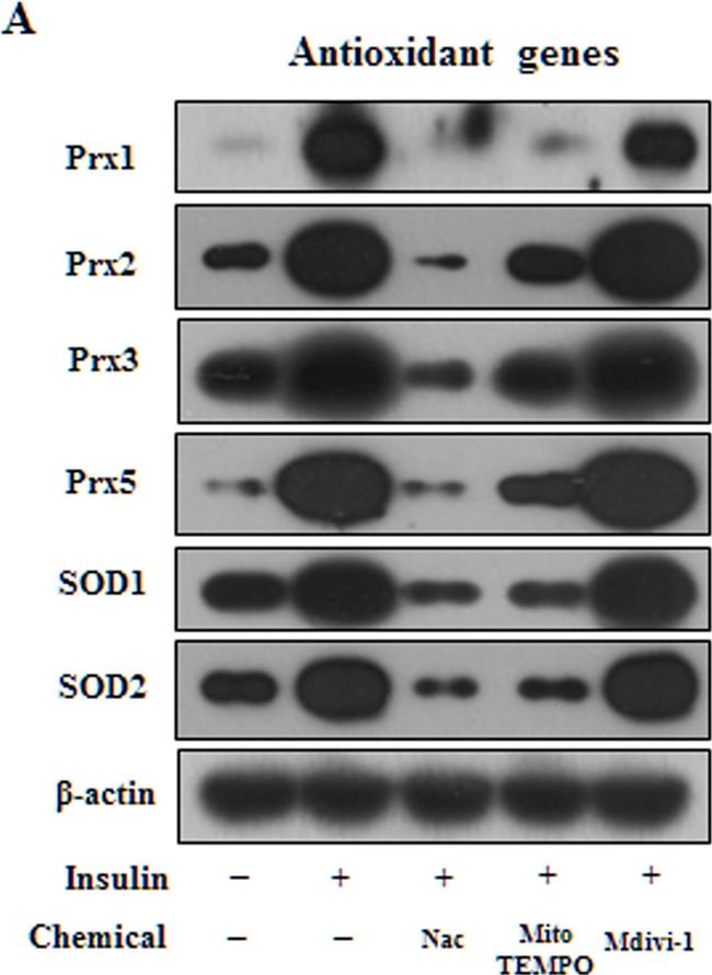 Rabbit IgG (H+L) Secondary Antibody in Western Blot (WB)