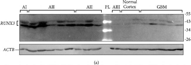 Rabbit IgG (H+L) Secondary Antibody in Western Blot (WB)