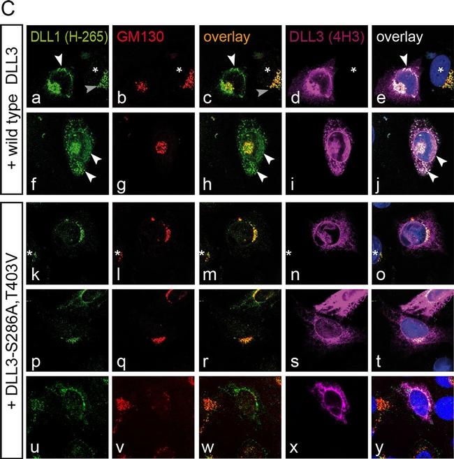 Rat IgG (H+L) Cross-Adsorbed Secondary Antibody in Immunocytochemistry (ICC/IF)