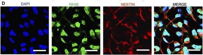 Mouse IgG (H+L) Cross-Adsorbed Secondary Antibody in Immunocytochemistry (ICC/IF)