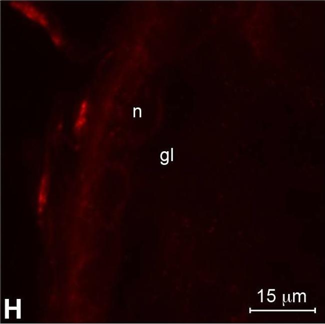 Rabbit IgG (H+L) Highly Cross-Adsorbed Secondary Antibody in Immunocytochemistry (ICC/IF)