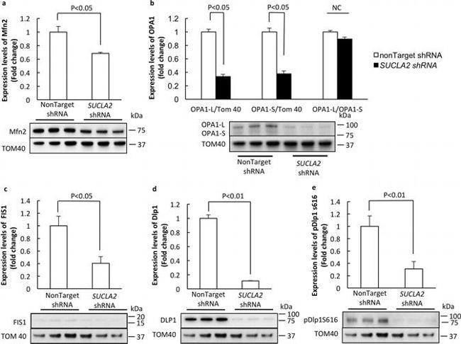 Rabbit IgG (H+L) Secondary Antibody in Western Blot (WB)