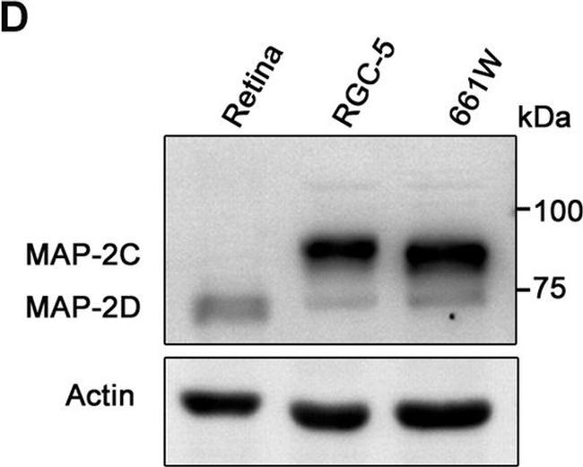 Rat IgG (H+L) Secondary Antibody in Western Blot (WB)