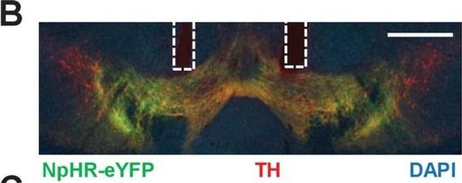 Mouse IgG (H+L) Cross-Adsorbed Secondary Antibody in Immunohistochemistry (IHC)