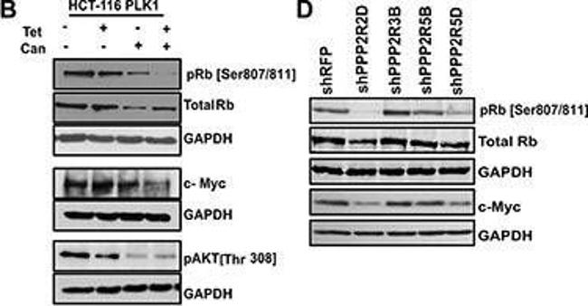 Rabbit IgG (H+L) Secondary Antibody in Western Blot (WB)