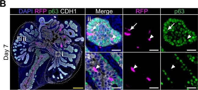 Goat IgG (H+L) Cross-Adsorbed Secondary Antibody in Immunohistochemistry (Paraffin) (IHC (P))