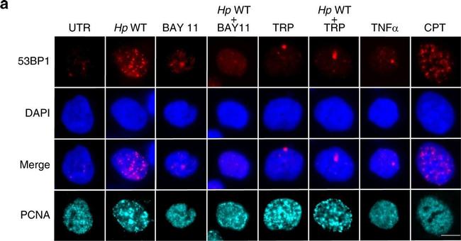 Rabbit IgG (H+L) Highly Cross-Adsorbed Secondary Antibody in Immunocytochemistry (ICC/IF)