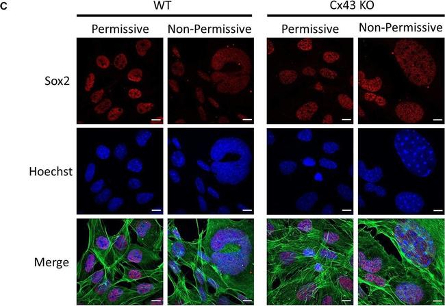 Rabbit IgG (H+L) Highly Cross-Adsorbed Secondary Antibody in Immunocytochemistry (ICC/IF)